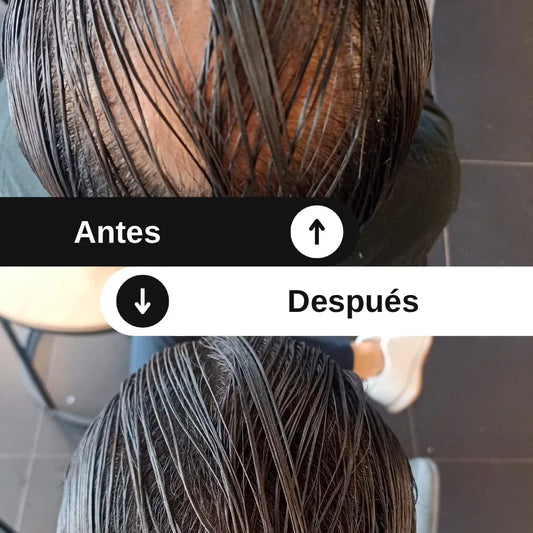 Spray Toppik - Productos para ocultar la pérdida capilar