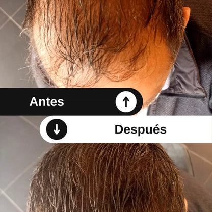 Spray Toppik - Productos para ocultar la pérdida capilar